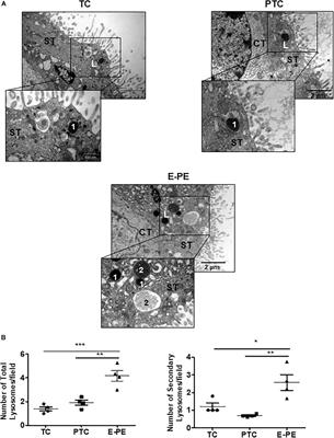 Ceramide-Induced Lysosomal Biogenesis and Exocytosis in Early-Onset Preeclampsia Promotes Exosomal Release of SMPD1 Causing Endothelial Dysfunction